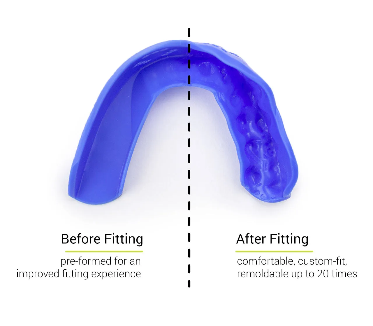 SISU 3D Mouthguard